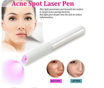 RubyBeam Acne Pen