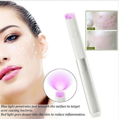RubyBeam Acne Pen