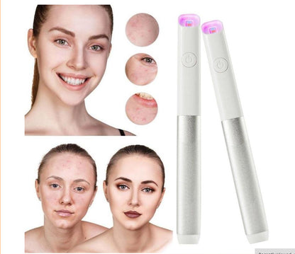 RubyBeam Acne Pen
